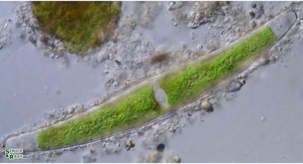 Closterium tumidum