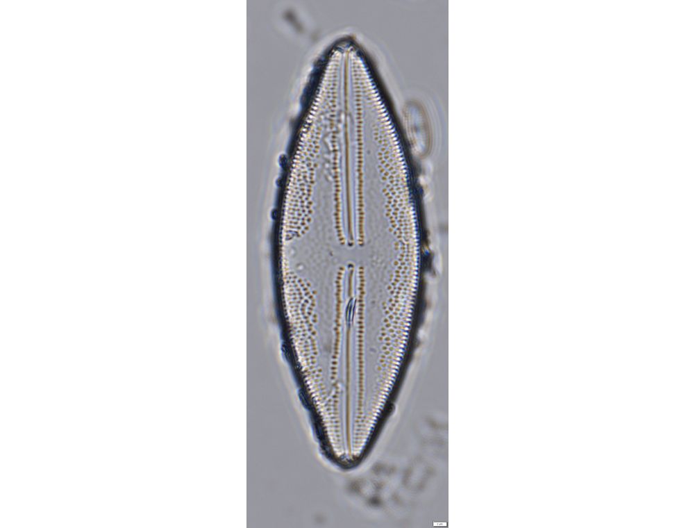 Anomoeoneis sphaerophora