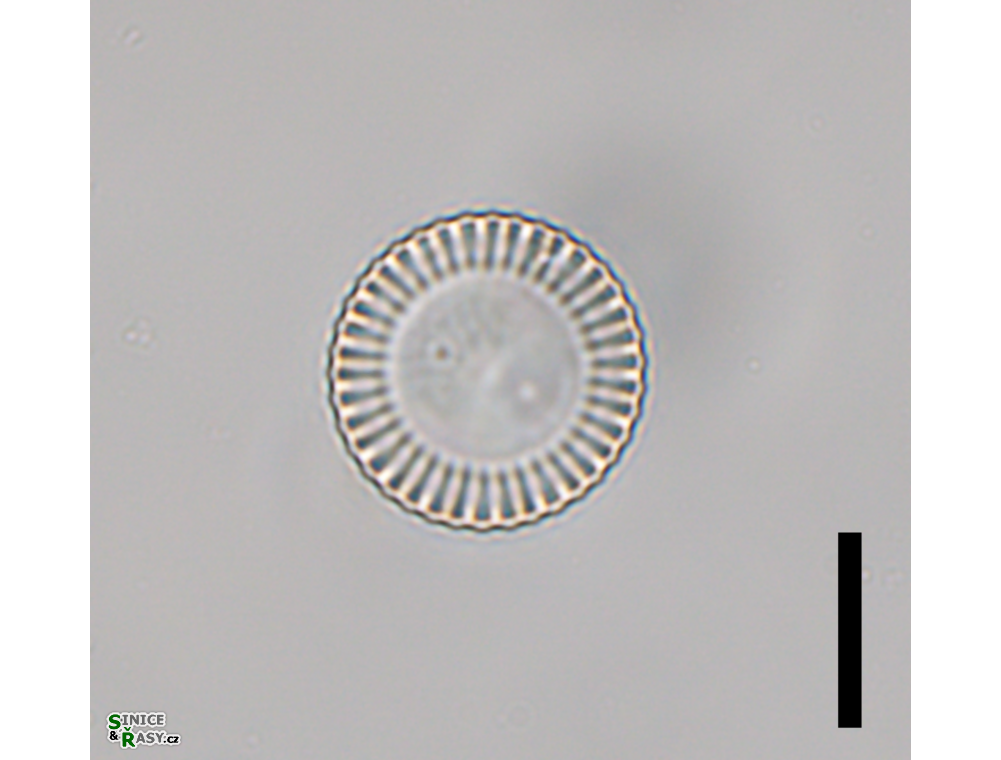 Cyclotella meneghiniana