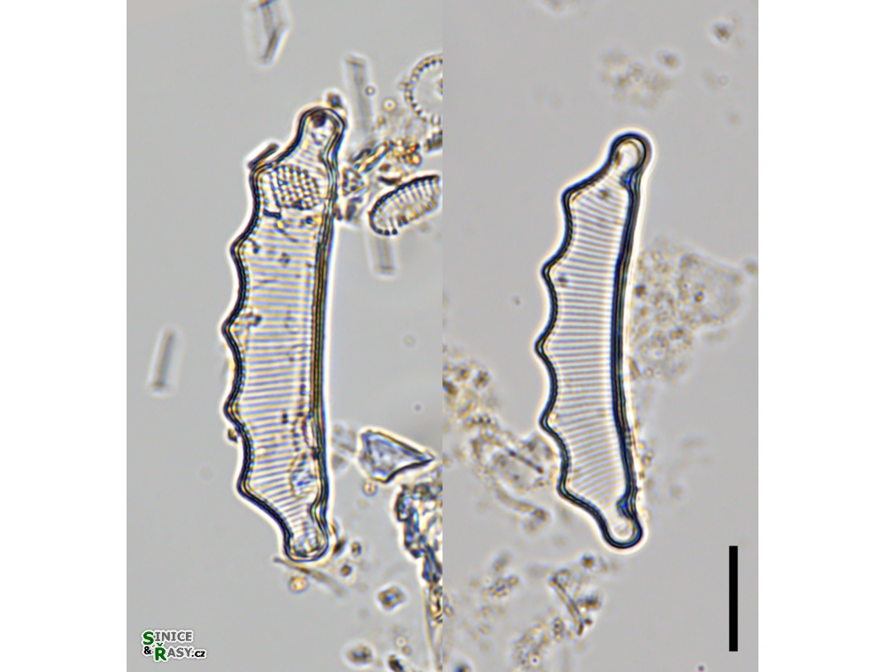 Eunotia hexaglyphis