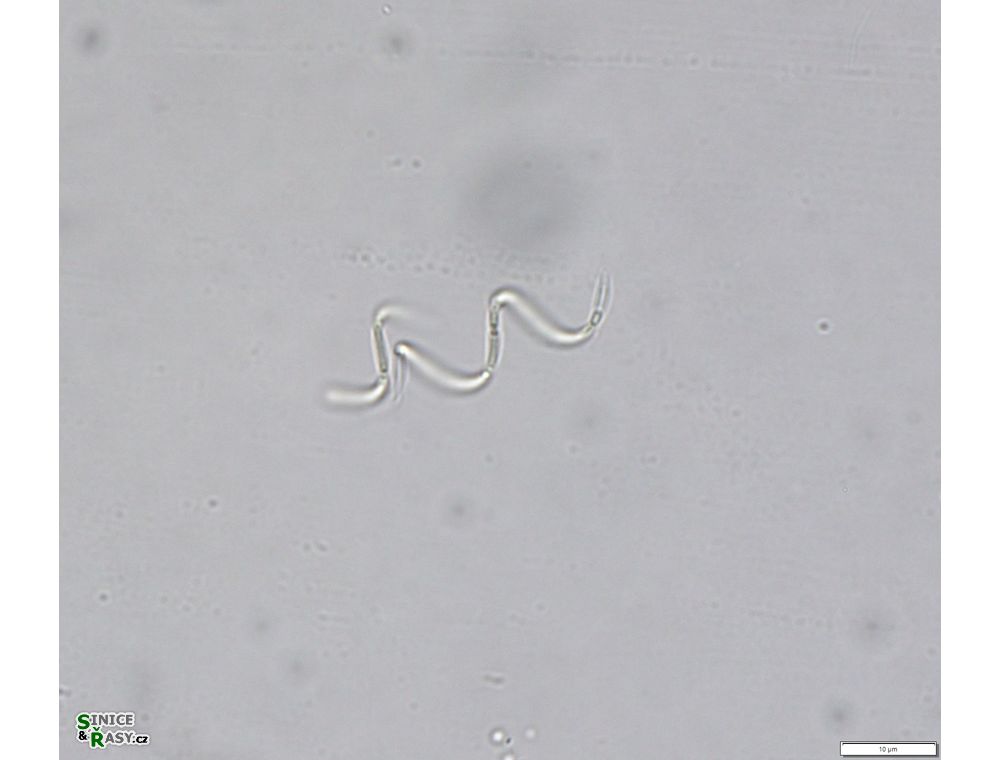 Planktolyngbya microspira