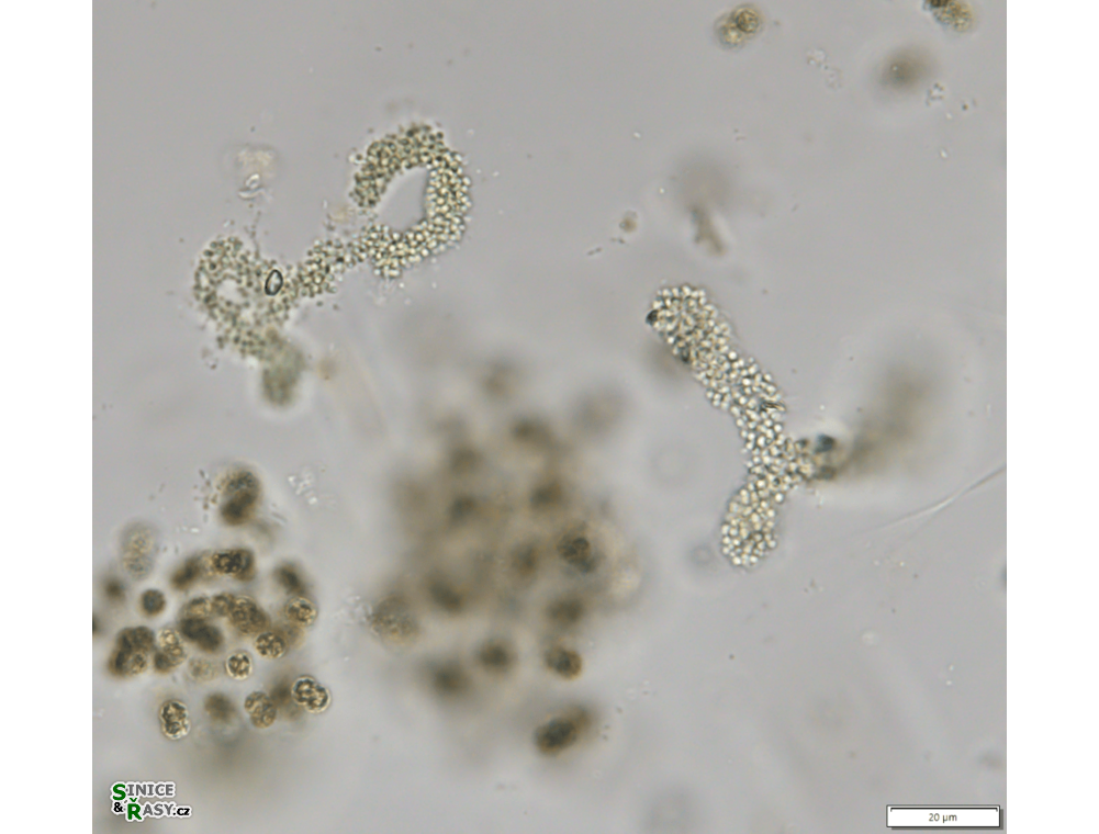 Aphanocapsa holsatica