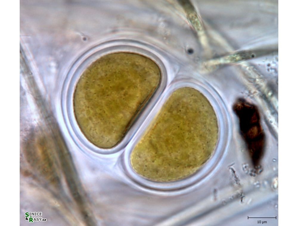 Chroococcus giganteus