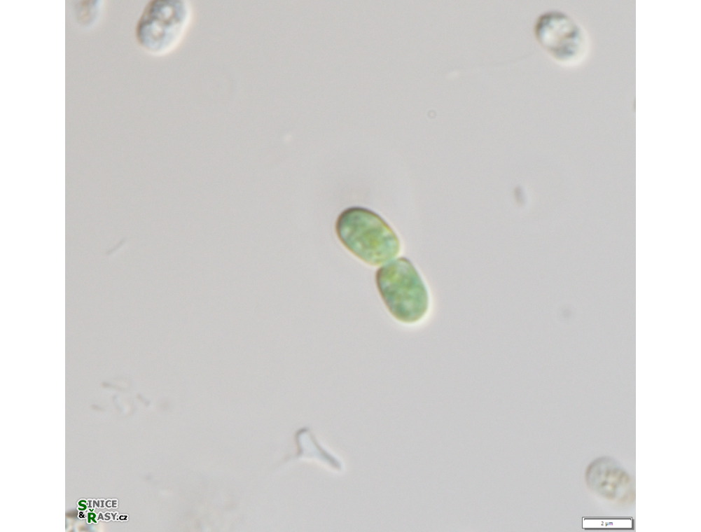 Cyanobacterium aponinum