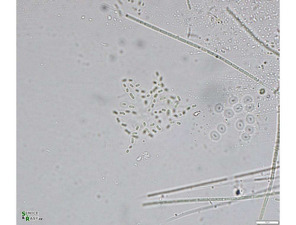 Cyanodictyon planctonicum