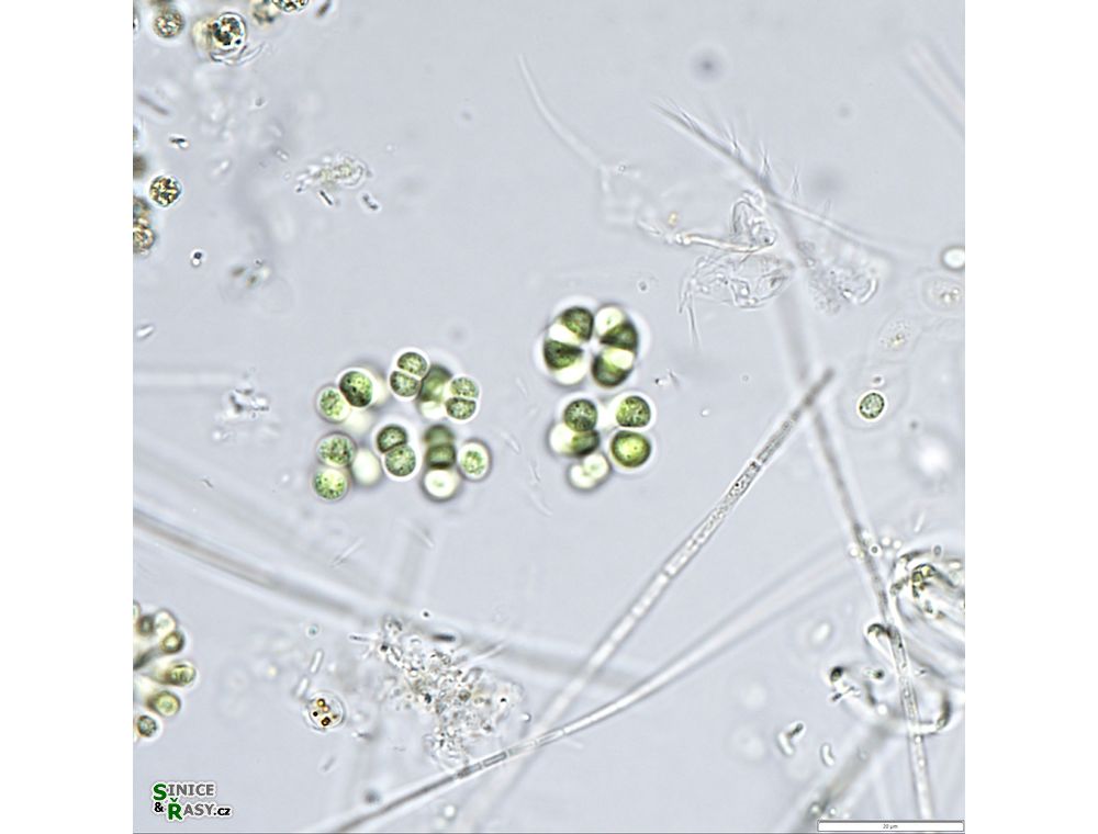 Limnococcus limneticus