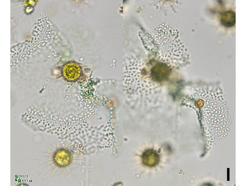 Pannus planus