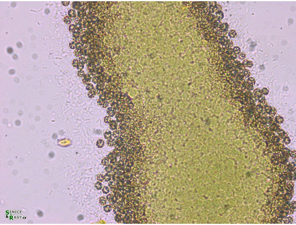 Synechocystis endobiotica