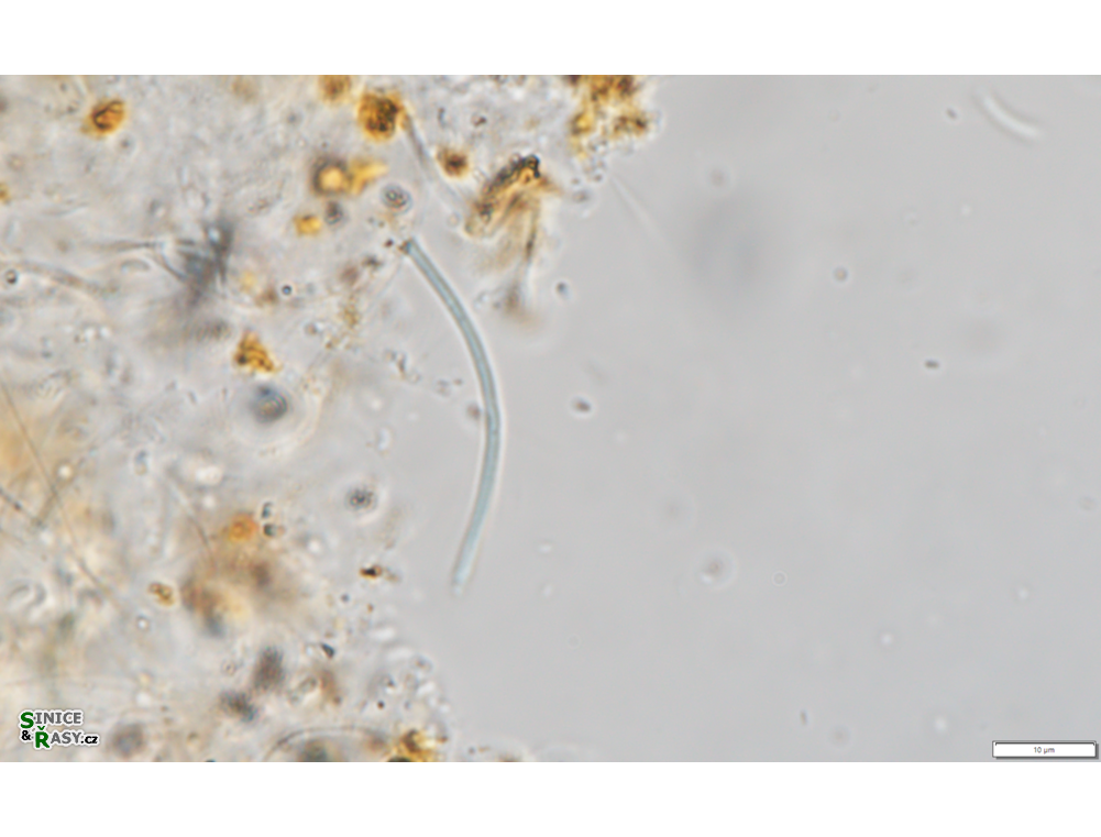 Thermostichus vescus