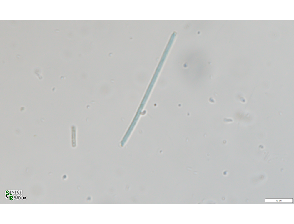 Thermostichus vescus