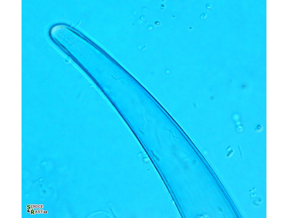 Closterium nematodes
