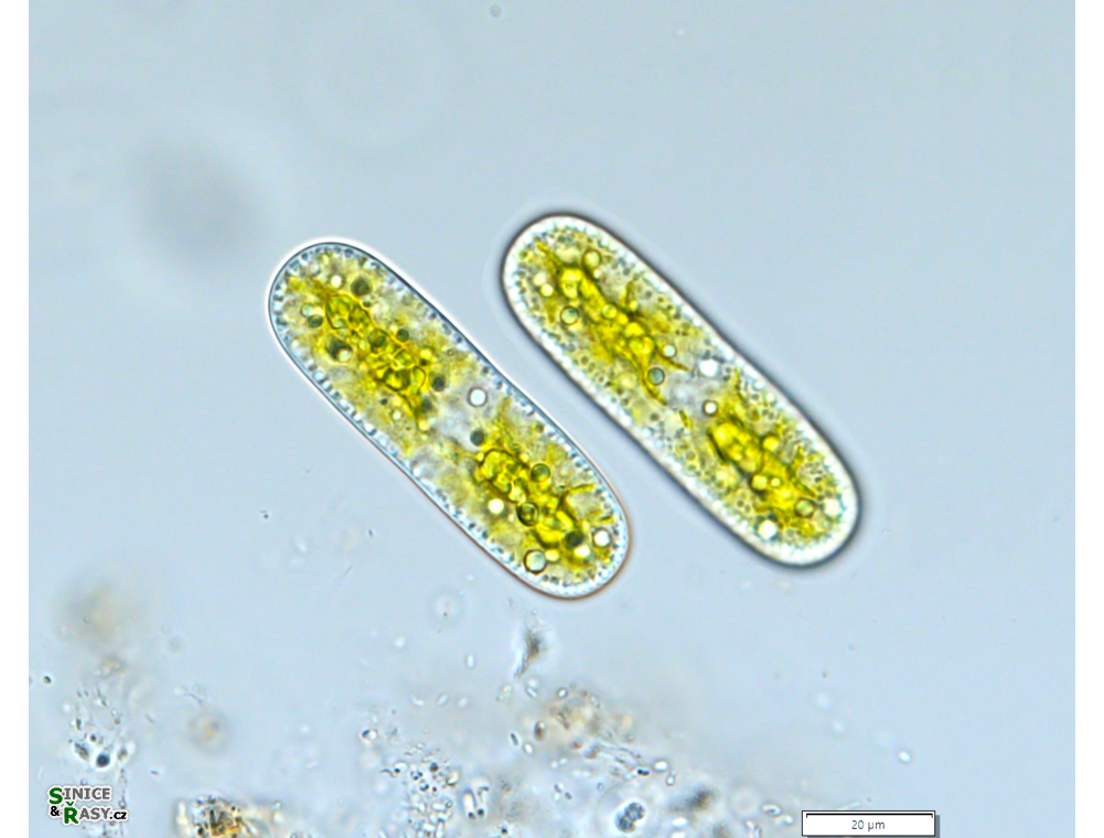 Cylindrocystis brebissonii