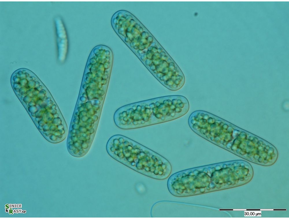 Cylindrocystis