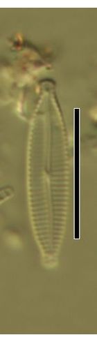 Encyonopsis microcephala