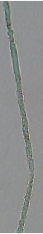 Dactylococcopsis sp.
