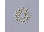 Lacunastrum gracilimum