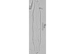 Pinnularia nodosa