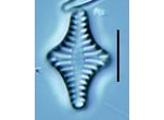 Staurosirella