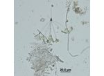 Ophiocytium arbuscula