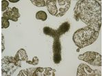 Microcystis