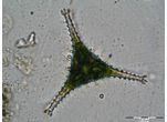 Staurastrum anatinum
