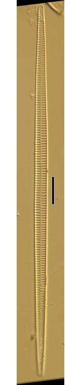 Synedra ulna
