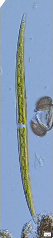 Closterium strigosum