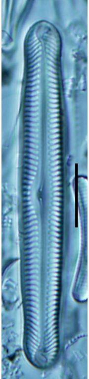 Pinnularia gibbiformis