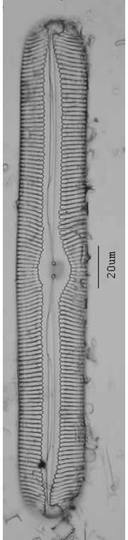 Pinnularia nobilis