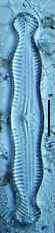 Pinnularia nodosa