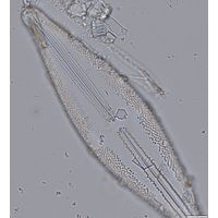 Anomoeoneis sphaerophora