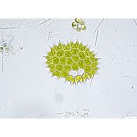 Pseudopediastrum boryanum