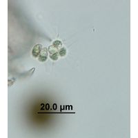 Micractinium pusillum