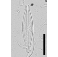 Brachysira neoexilis