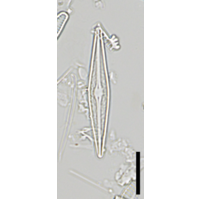 Brachysira vitrea