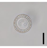 Cyclotella meneghiniana