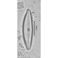 Cymbella leptoceros