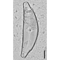 Cymbella tumida
