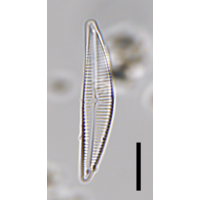 Encyonema neogracile