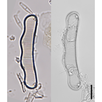 Eunotia neoscandinavica