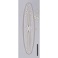 Frustulia vulgaris