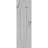 Pinnularia nodosa