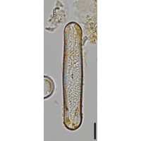 Pinnularia acrosphaeria