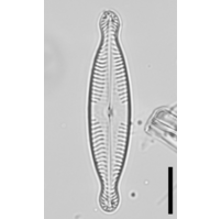 Pinnularia brauniana