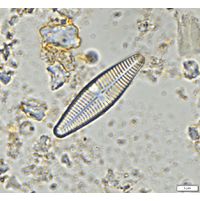 Planothidium lanceolatum