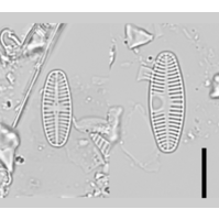 Planothidium lanceolatum