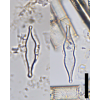 Pseudostaurosira subconstricta