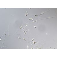 Urosolenia longiseta