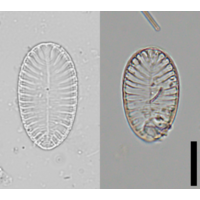 Surirella brebissonii