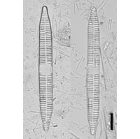 Ulnaria ulna